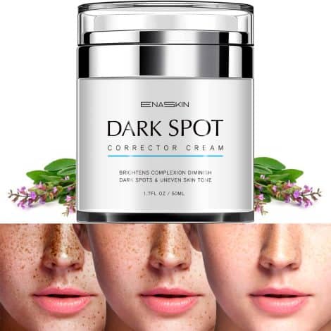 EnaSkin Dark Spot Eraser: All-Natural Cream for Clearing Freckles, Melasma, Sun and Age Spots on Face and Body.